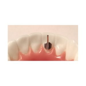 AMERICAN ORTHODONTICS / Pique langue
