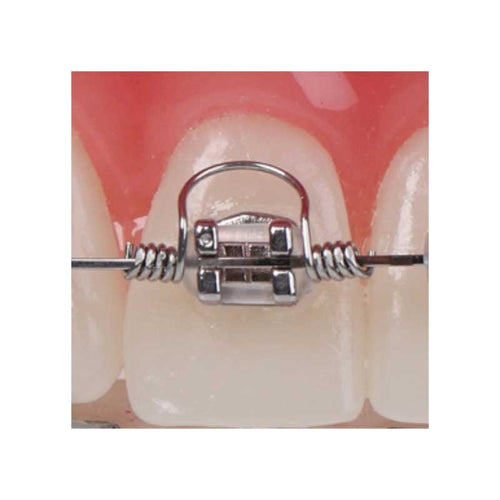 AMERICAN ORTHODONTICS / Warren Torquing Spring
