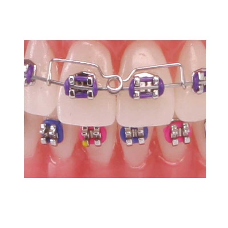 AMERICAN ORTHODONTICS / Torquing Spring