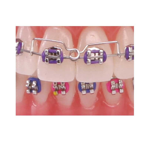 AMERICAN ORTHODONTICS / Torquing Spring