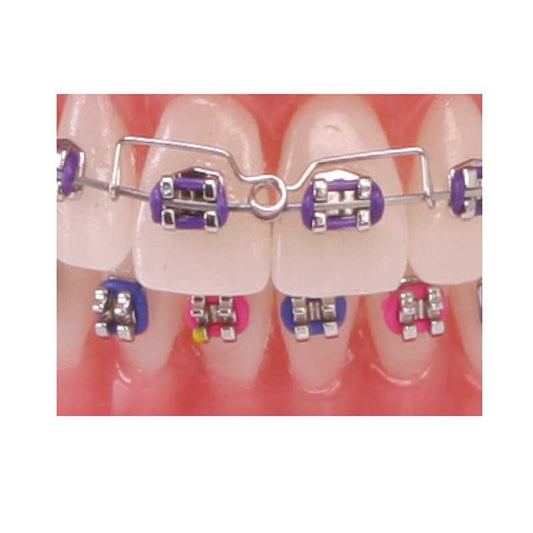 AMERICAN ORTHODONTICS / Torquing Spring